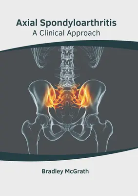 Axial Spondyloarthritis: O abordare clinică - Axial Spondyloarthritis: A Clinical Approach