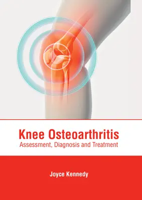 Osteoartrita genunchiului: Evaluare, diagnostic și tratament - Knee Osteoarthritis: Assessment, Diagnosis and Treatment