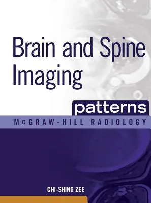 Brain and Spine Imaging Patterns: Imagistica creierului și a coloanei vertebrale - Brain and Spine Imaging Patterns: Brain & Spine Imaging