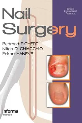 Chirurgia unghiilor - Nail Surgery