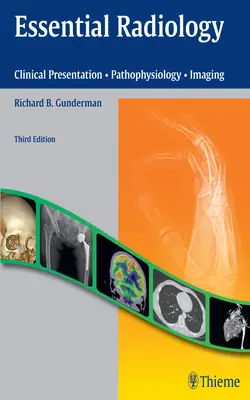Radiologie esențială: Prezentare clinică - Patofiziologie - Imagistică - Essential Radiology: Clinical Presentation - Pathophysiology - Imaging