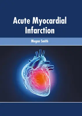 Infarct miocardic acut - Acute Myocardial Infarction