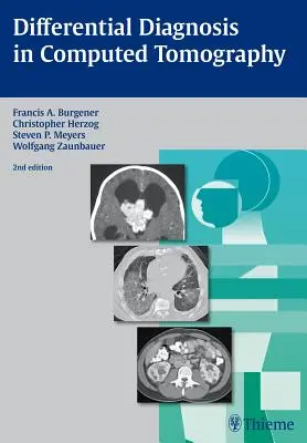 Diagnostic diferențial în tomografia computerizată (Differential Diagnosis in Computed Tomography) - Differential Diagnosis in Computed Tomography