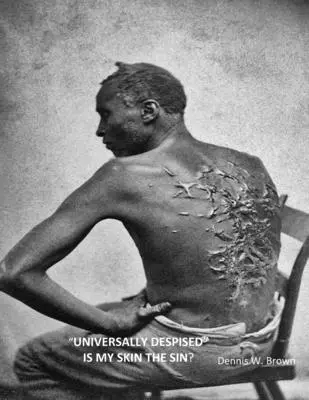 Universal disprețuită Pielea mea este păcatul? - Universally Despised Is My Skin the Sin?