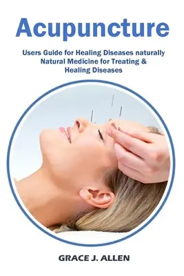 Acupunctura: Ghidul utilizatorului pentru vindecarea bolilor Medicină naturală naturală pentru tratarea și vindecarea bolilor - Acupuncture: Users Guide for Healing Diseases naturally Natural Medicine for Treating & Healing Diseases