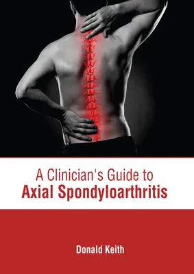 Ghidul clinicianului pentru spondiloartrita axială - A Clinician's Guide to Axial Spondyloarthritis