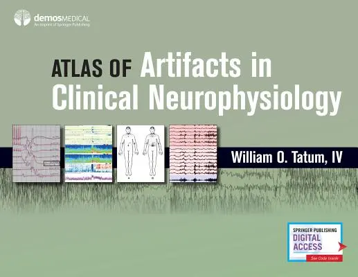 Atlas de artefacte în neurofiziologia clinică - Atlas of Artifacts in Clinical Neurophysiology