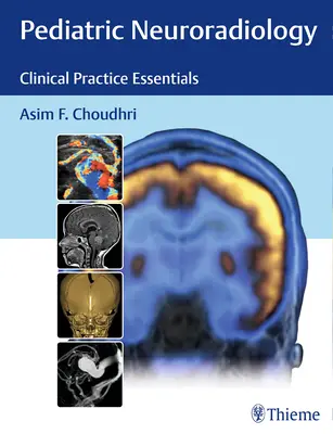 Neuroradiologie pediatrică: Esențial în practica clinică - Pediatric Neuroradiology: Clinical Practice Essentials