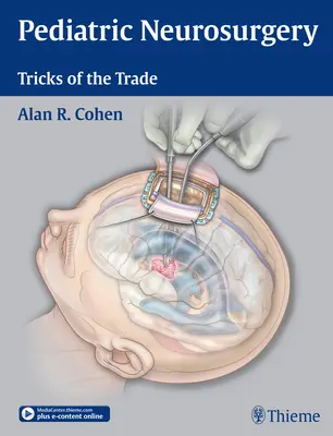 Neurochirurgie pediatrică: Trucuri de meserie - Pediatric Neurosurgery: Tricks of the Trade