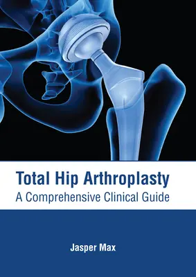 Artroplastia totală de șold: Un ghid clinic cuprinzător - Total Hip Arthroplasty: A Comprehensive Clinical Guide