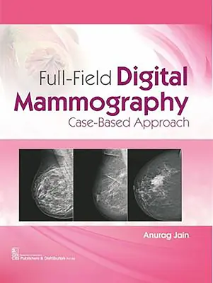 Mamografie digitală în câmp complet: Abordare bazată pe cazuri - Full-Field Digital Mammography: Case-Based Approach