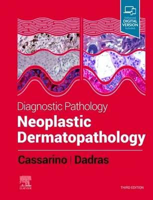 Diagnostic patologic: Dermatopatologie neoplastică - Diagnostic Pathology: Neoplastic Dermatopathology