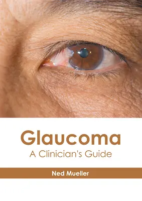 Glaucom: Ghidul unui clinician - Glaucoma: A Clinician's Guide