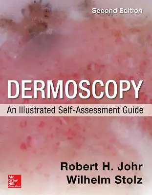 Dermoscopie: Un ghid ilustrat de autoevaluare, 2/E - Dermoscopy: An Illustrated Self-Assessment Guide, 2/E