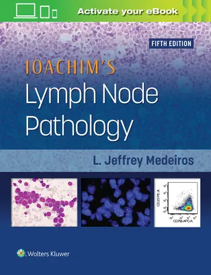 Patologia ganglionilor limfatici a lui Ioachim - Ioachim's Lymph Node Pathology