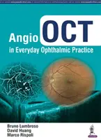 Angio Oct în practica oftalmologică de zi cu zi - Angio Oct in Everyday Ophthalmic Practice