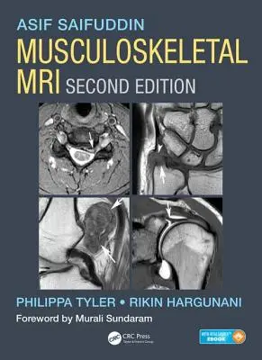 RMN musculo-scheletal - Musculoskeletal MRI