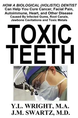 Dinți toxici: Cum vă poate ajuta un dentist biologic (holistic) să vindecați cancerul, durerile faciale, bolile autoimune, cardiace și alte boli cauzate - Toxic Teeth: How a Biological (Holistic) Dentist Can Help You Cure Cancer, Facial Pain, Autoimmune, Heart, and Other Disease Caused