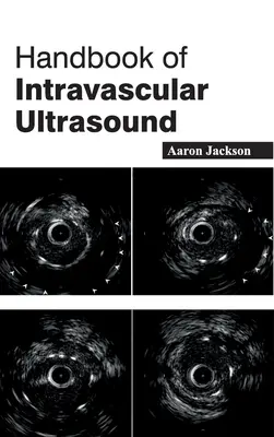Manual de ultrasunete intravasculare - Handbook of Intravascular Ultrasound