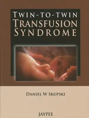 Sindromul transfuziei de la gemeni la gemeni (Twin-To-Twin Transfusion Syndrome) - Twin-To-Twin Transfusion Syndrome