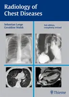 Radiologia bolilor toracice (Radiology of Chest Diseases) - Radiology of Chest Diseases