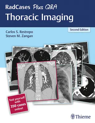 Radcases Plus Q&A Imagistică toracică - Radcases Plus Q&A Thoracic Imaging