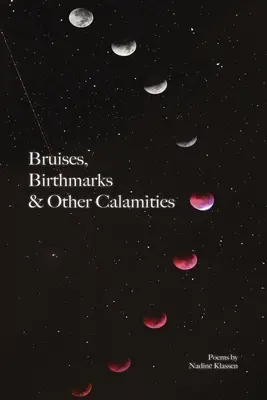 Vânătăi, semne din naștere și alte calamități - Bruises, Birthmarks & Other Calamities