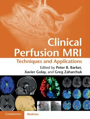 IRM de perfuzie clinică: Tehnici și aplicații - Clinical Perfusion MRI: Techniques and Applications