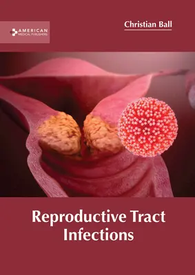 Infecțiile tractului reproducător - Reproductive Tract Infections