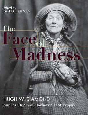 Fața nebuniei: Hugh W. Diamond și originea fotografiei psihiatrice - Face of Madness: Hugh W. Diamond and the Origin of Psychiatric Photography