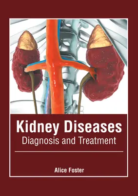 Boli ale rinichilor: Diagnostic și tratament - Kidney Diseases: Diagnosis and Treatment