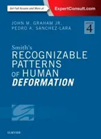 Smith's Recognizable Patterns of Human Deformation