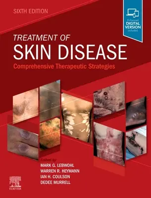 Tratamentul bolilor de piele: Strategii terapeutice cuprinzătoare - Treatment of Skin Disease: Comprehensive Therapeutic Strategies