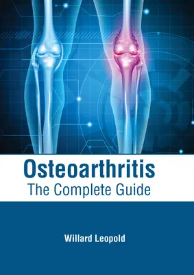 Osteoartrita: Ghidul complet - Osteoarthritis: The Complete Guide