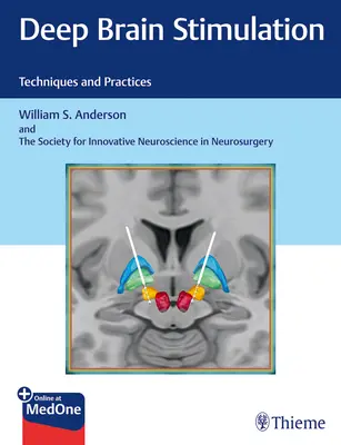 Stimulare cerebrală profundă: Tehnici și practici - Deep Brain Stimulation: Techniques and Practices