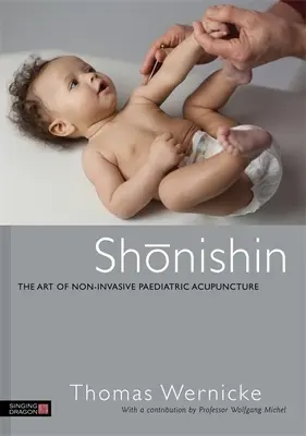 Shonishin: Arta acupuncturii pediatrice neinvazive - Shonishin: The Art of Non-Invasive Paediatric Acupuncture