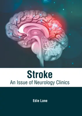 Stroke: O ediție a Neurology Clinics - Stroke: An Issue of Neurology Clinics