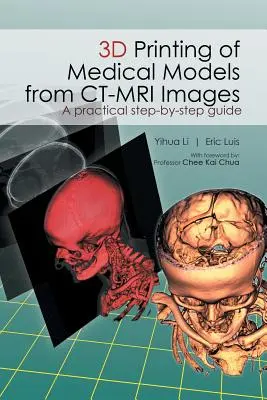 Imprimarea 3D a modelelor medicale din imagini CT-MRI: Un ghid practic pas cu pas - 3D Printing of Medical Models from CT-MRI Images: A Practical step-by-step guide