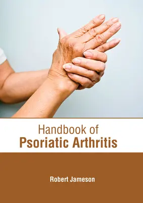 Manual de artrită psoriazică - Handbook of Psoriatic Arthritis