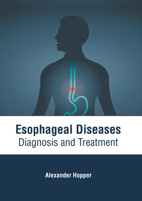 Boli ale esofagului: Diagnostic și tratament - Esophageal Diseases: Diagnosis and Treatment