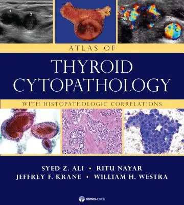 Atlas de citopatologie tiroidiană: Cu corelații histopatologice - Atlas of Thyroid Cytopathology: With Histopathologic Correlations