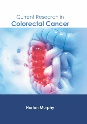 Cercetări actuale în domeniul cancerului colorectal - Current Research in Colorectal Cancer