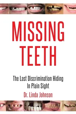 Dinți lipsă: Ultima discriminare ascunsă la vedere - Missing Teeth: The Last Discrimination Hiding in Plain Sight