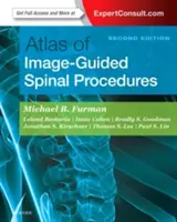 Atlasul procedurilor spinale ghidate de imagini (Atlas of Image-Guided Spinal Procedures) - Atlas of Image-Guided Spinal Procedures