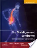 Sindromul de malalignizare: Diagnosticul și tratamentul durerilor pelviene și de spate comune - The Malalignment Syndrome: Diagnosis and Treatment of Common Pelvic and Back Pain