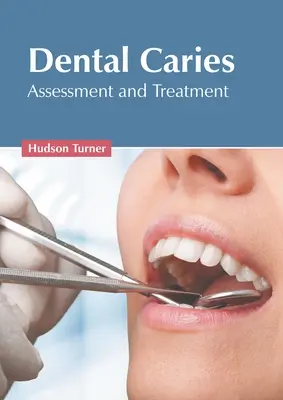 Cariile dentare: Evaluare și tratament - Dental Caries: Assessment and Treatment