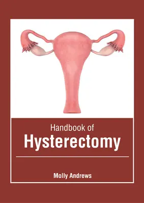 Manual de histerectomie - Handbook of Hysterectomy