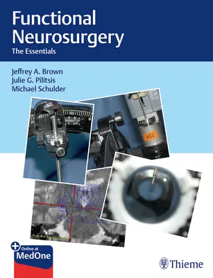 Neurochirurgie funcțională: Esențial - Functional Neurosurgery: The Essentials