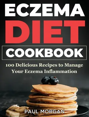 Eczema DIet Carte de bucate: 100 de rețete delicioase pentru a vă gestiona inflamația eczemelor - Eczema DIet Cookbook: 100 Delicious Recipes to Manage your Eczema Inflammation