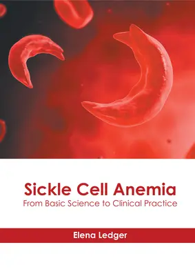 Anemia celulelor falciforme: De la știința de bază la practica clinică - Sickle Cell Anemia: From Basic Science to Clinical Practice